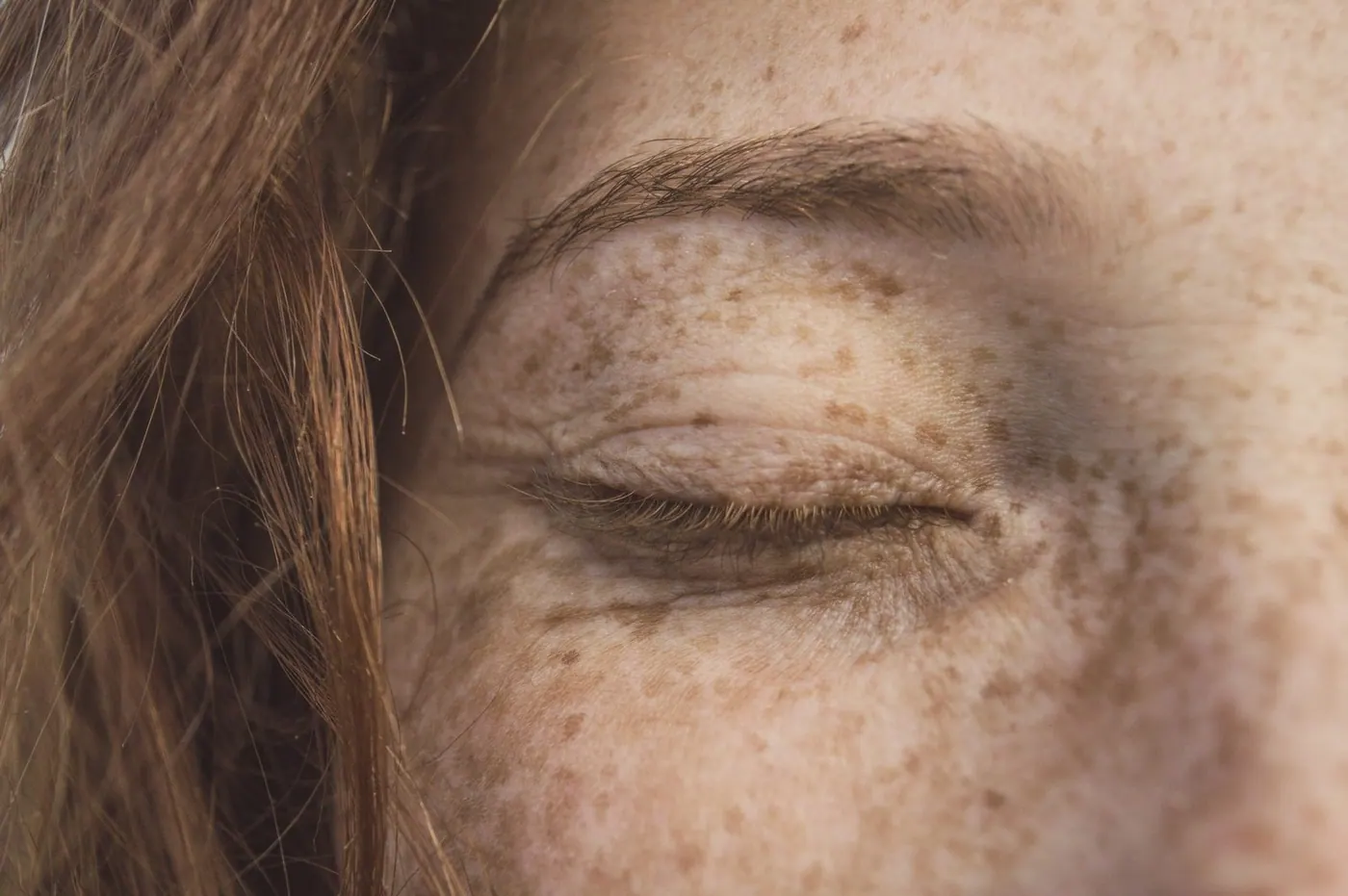 Close-up of a partially closed eye with prominent freckles on the eyelid and surrounding skin, and brown hair brushing against the face.